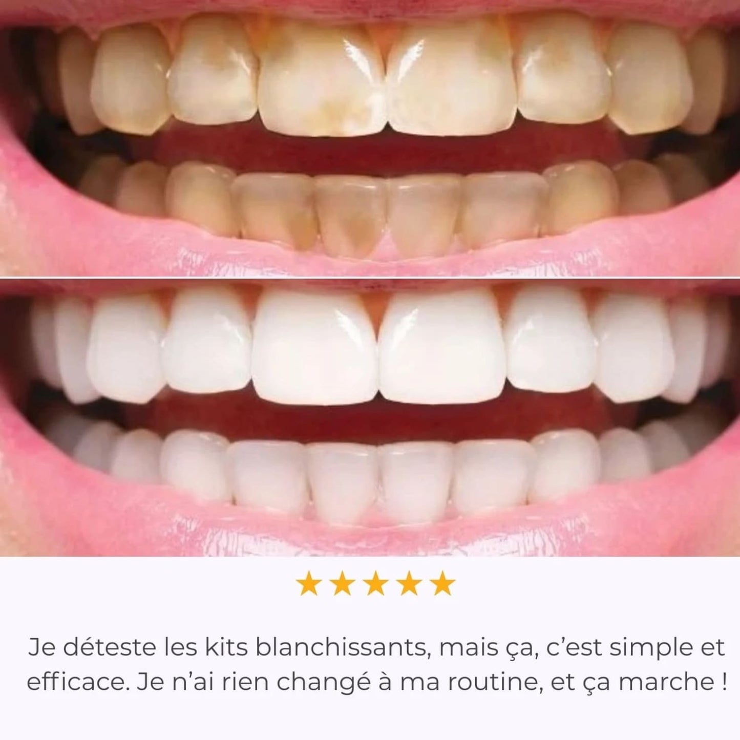 IVISMILE – Brosse à dents LED