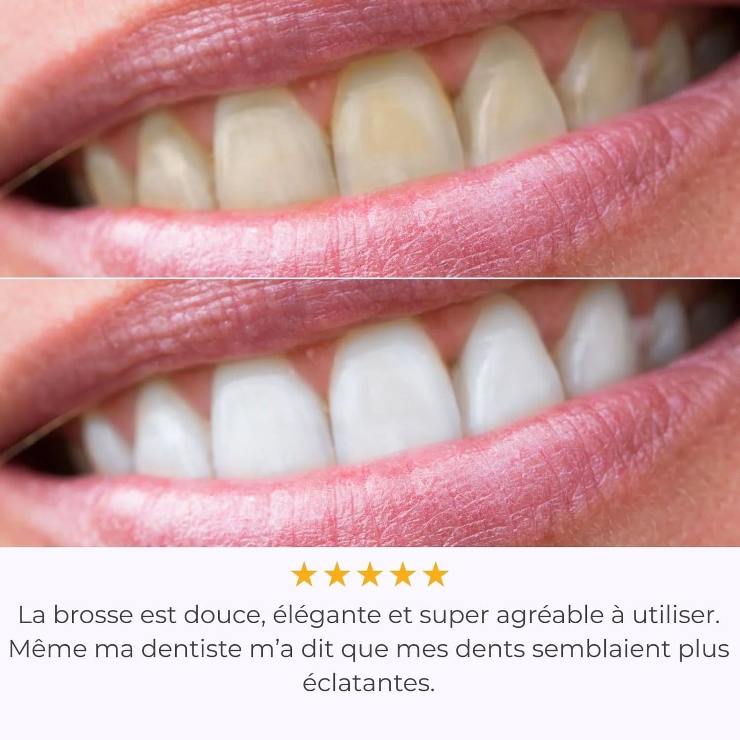 IVISMILE – Brosse à dents LED