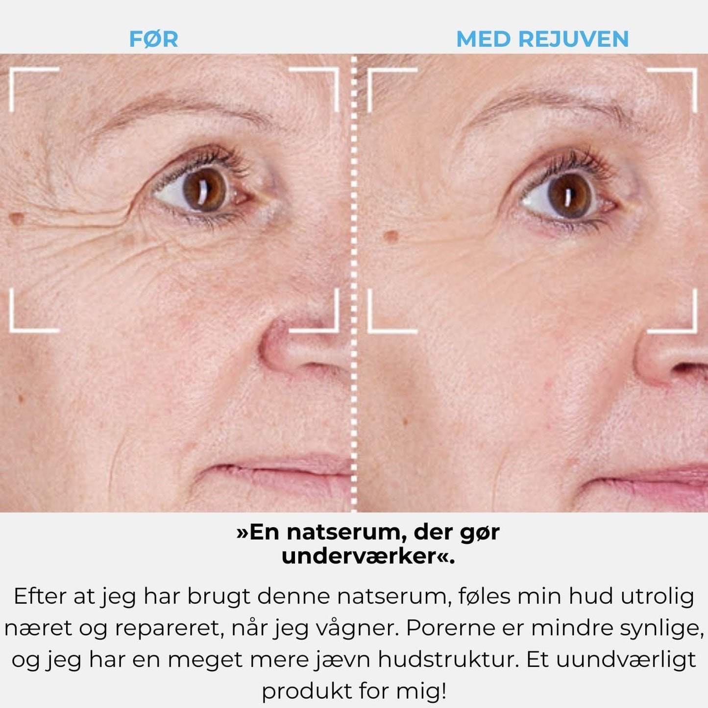 Rejuven-abonnement