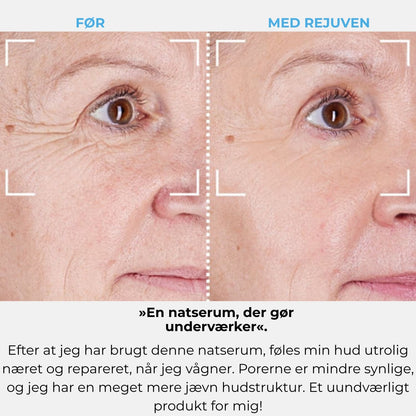 Rejuven-abonnement