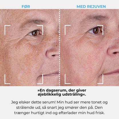 Rejuven-abonnement
