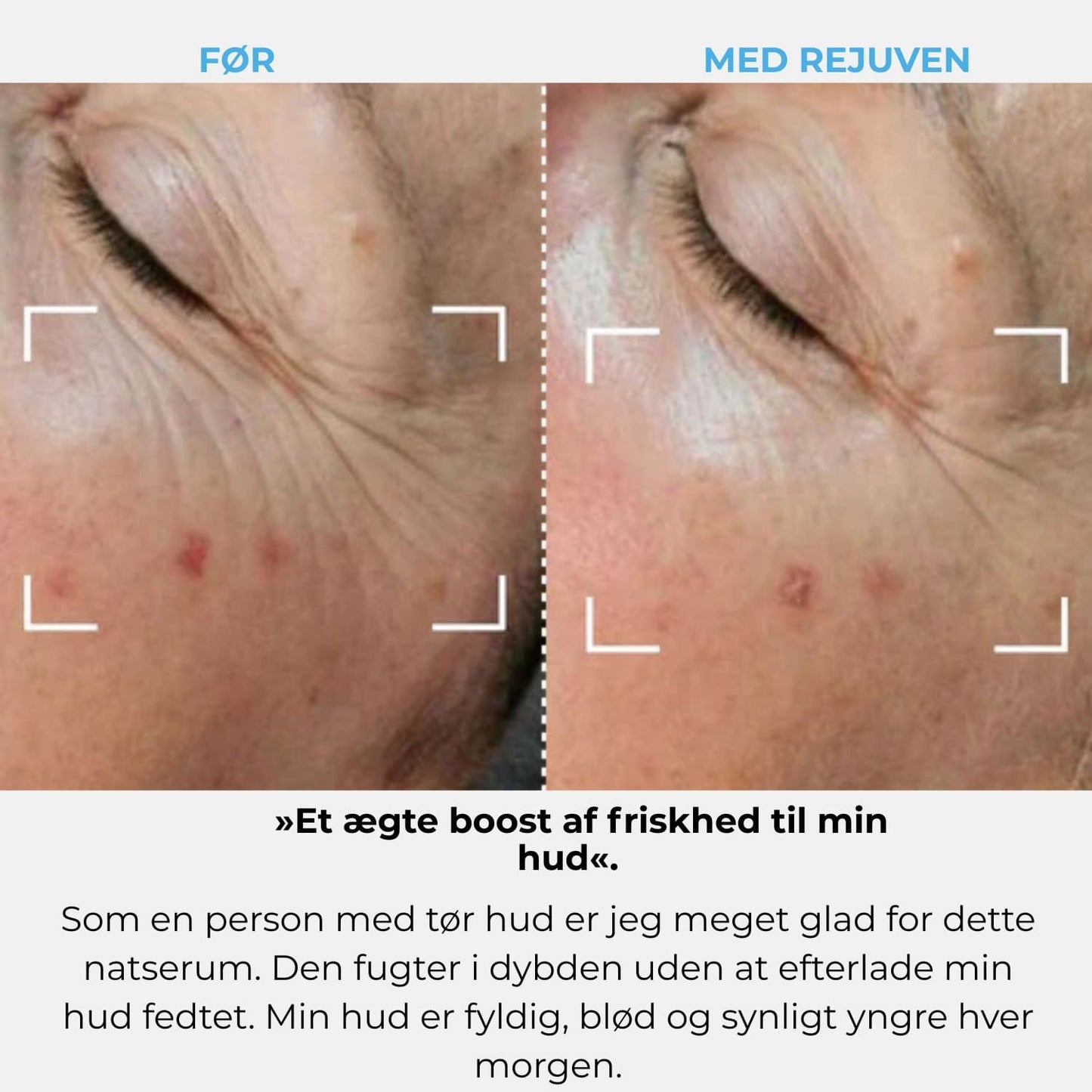 Rejuven-abonnement