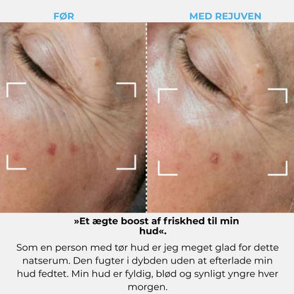 Rejuven-abonnement